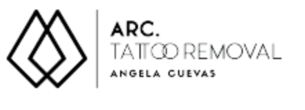 ARC TATTOO REMOVA